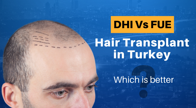 DHI Vs FUE Hair Transplant In Turkey: Which Is Better? | BlueMagic Group